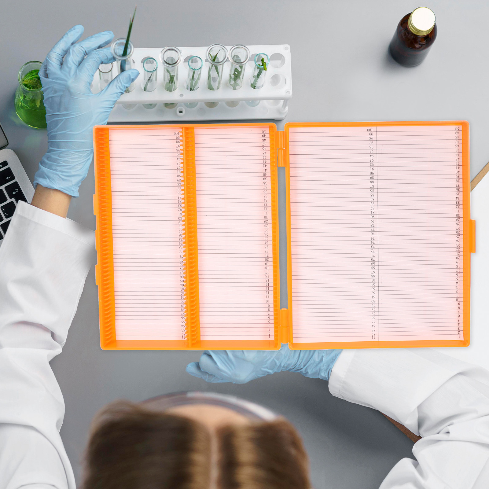 100-teilige Objektträger-Aufbe – Pathology Slide Storage Bewertung und Preis