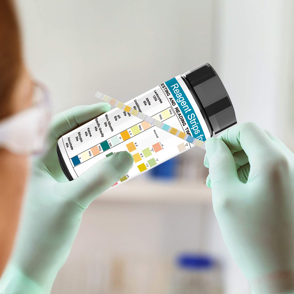 100 Streifen Urinprüfstreifen  – Urinalysis Reagent Strip Bewertung und Preis