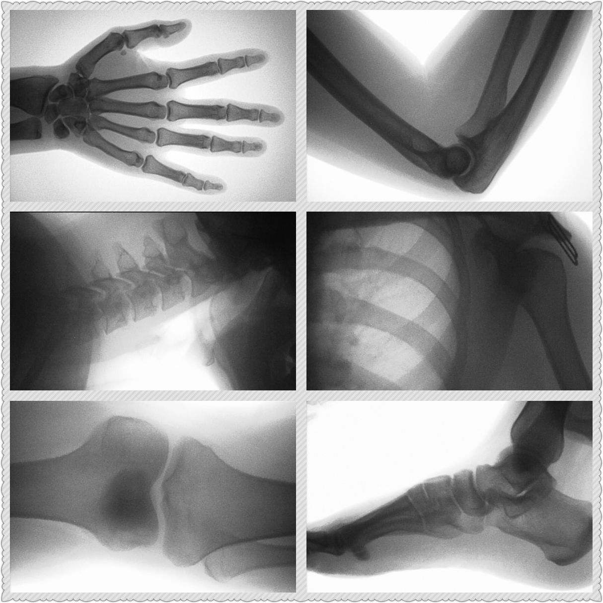 Schnelle Frakturdiagnose bei H – Veterinary X-Ray Bewertung und Preis