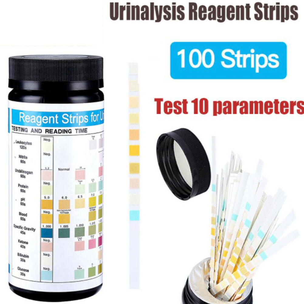 100 Streifen URS-10T Reagenz-U – Urinalysis Reagent Strip Bewertung und Preis